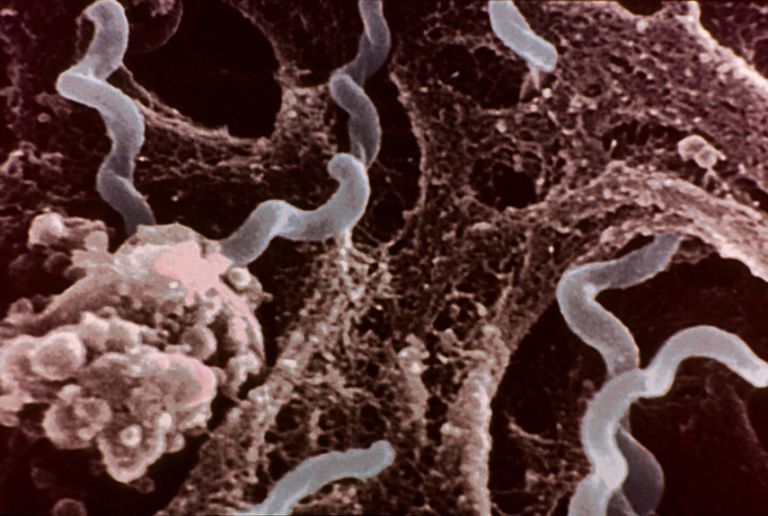 6 Diseases Back from the Dead